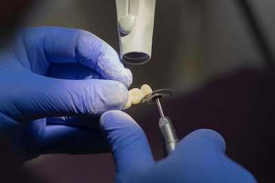 implanty zębowe Szczecin